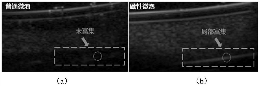 Magnetic acoustic contrast agent composition, magnetic acoustic contrast agent, magnetic microvesicle acoustic contrast agent and preparation method of magnetic acoustic contrast agent