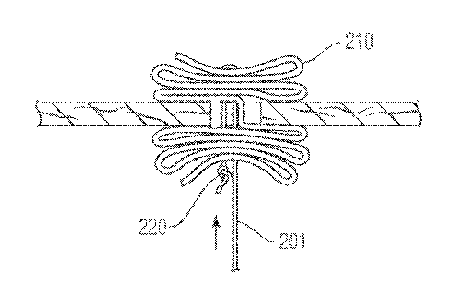 Devices for treating paravalvular leakage and methods use thereof