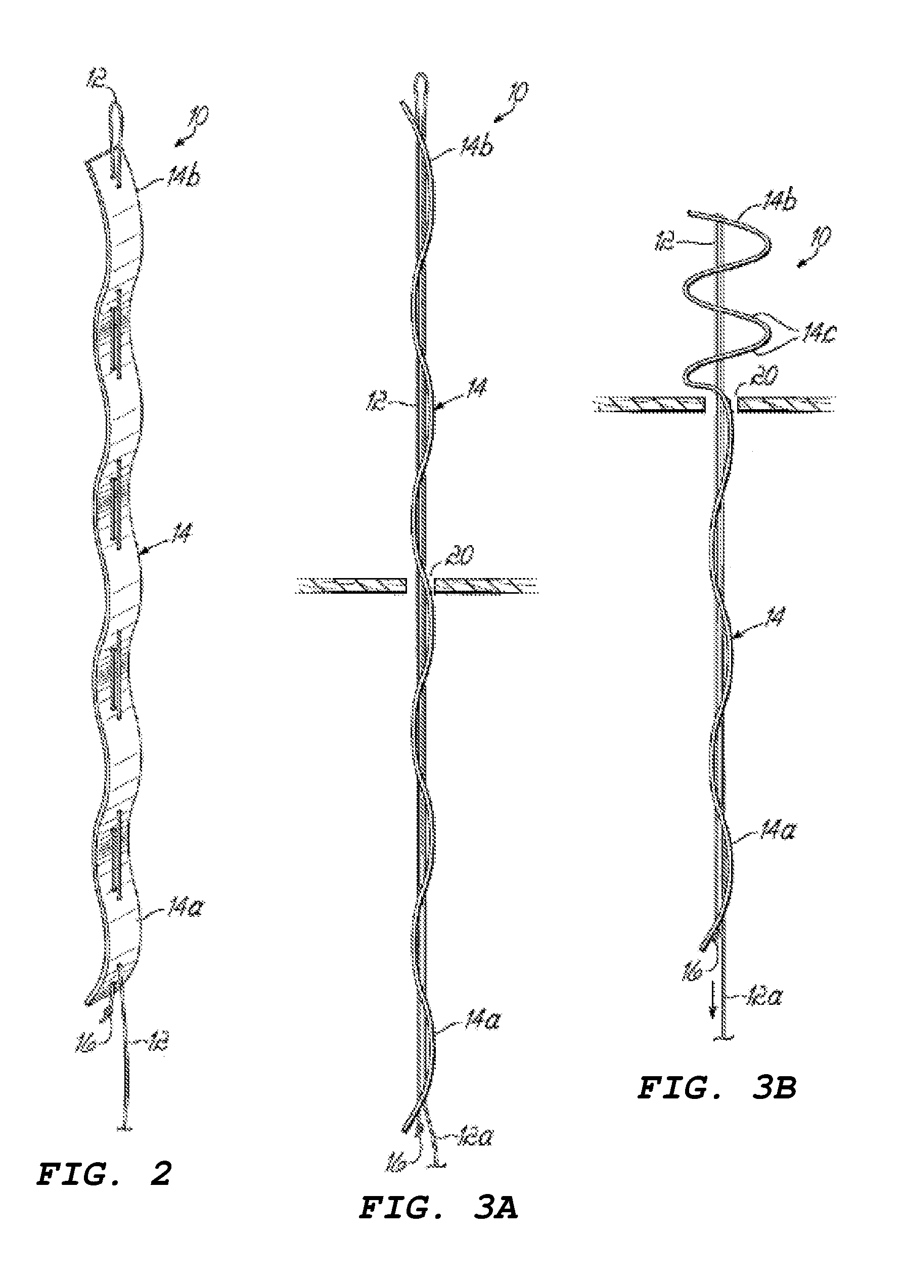 Devices for treating paravalvular leakage and methods use thereof