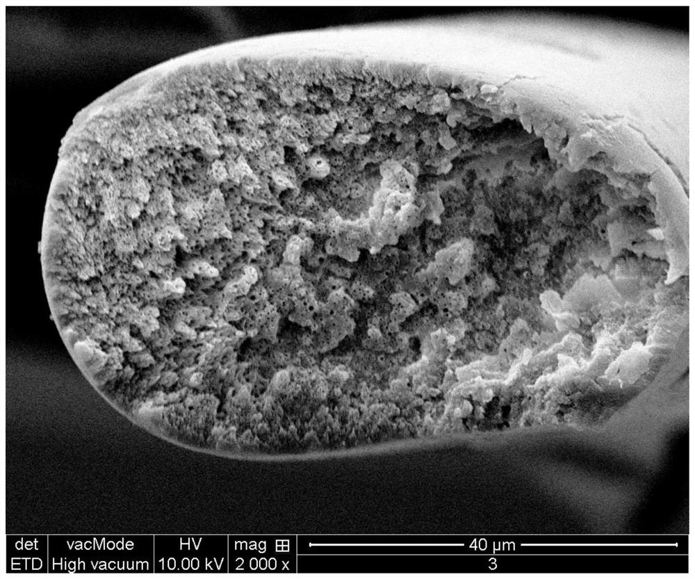 Composite drug-loaded fiber for absorbable surgical suture