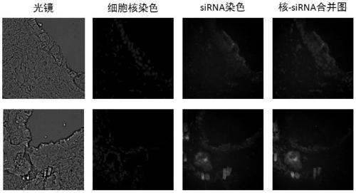 A kind of transdermal peptide and its application