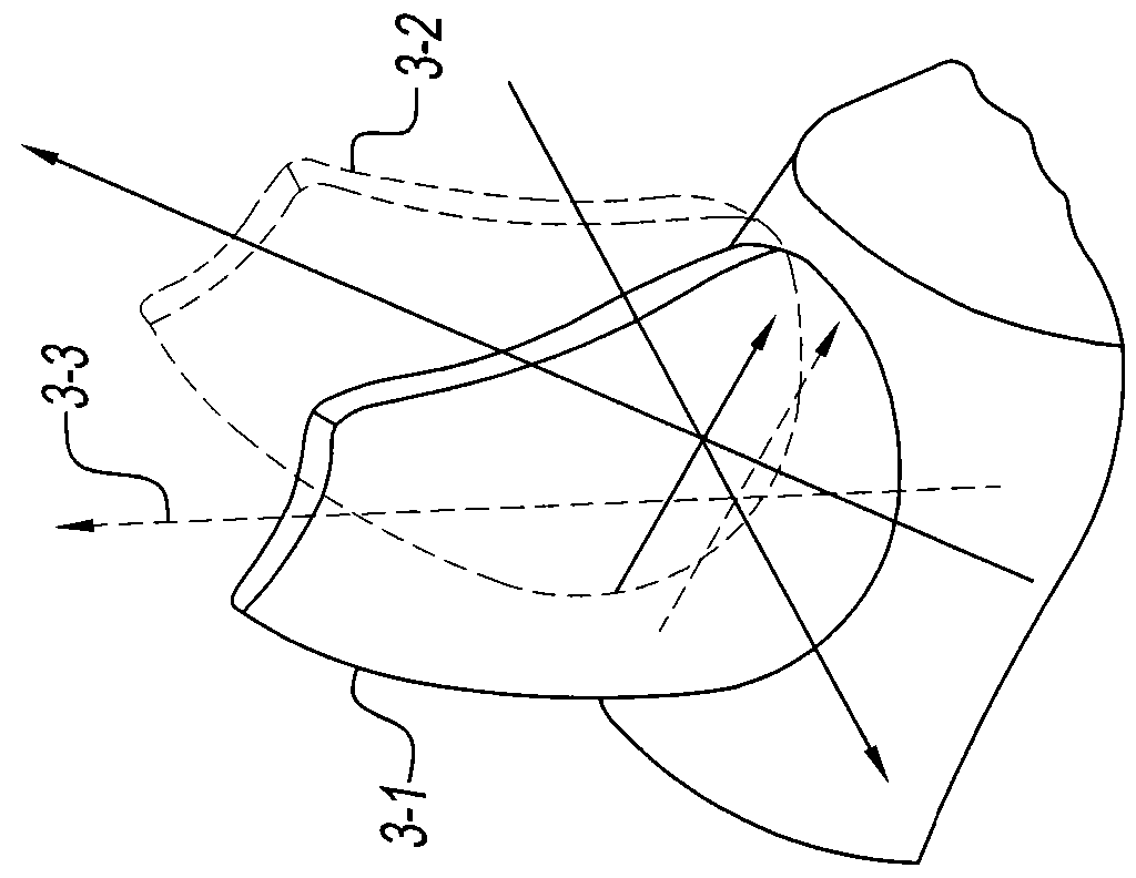 Orthodontic device