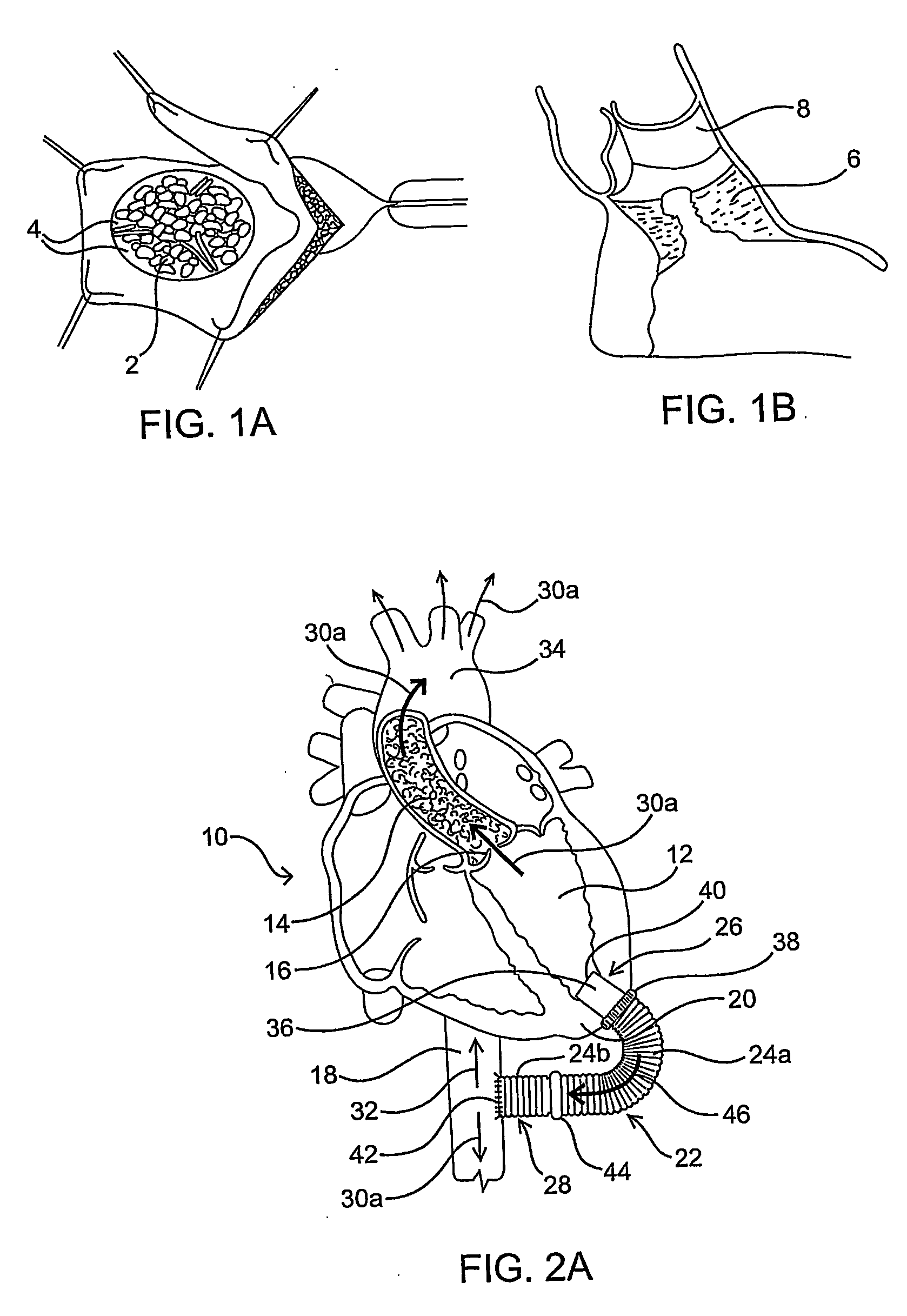 Methods and devices for improving cardiac output