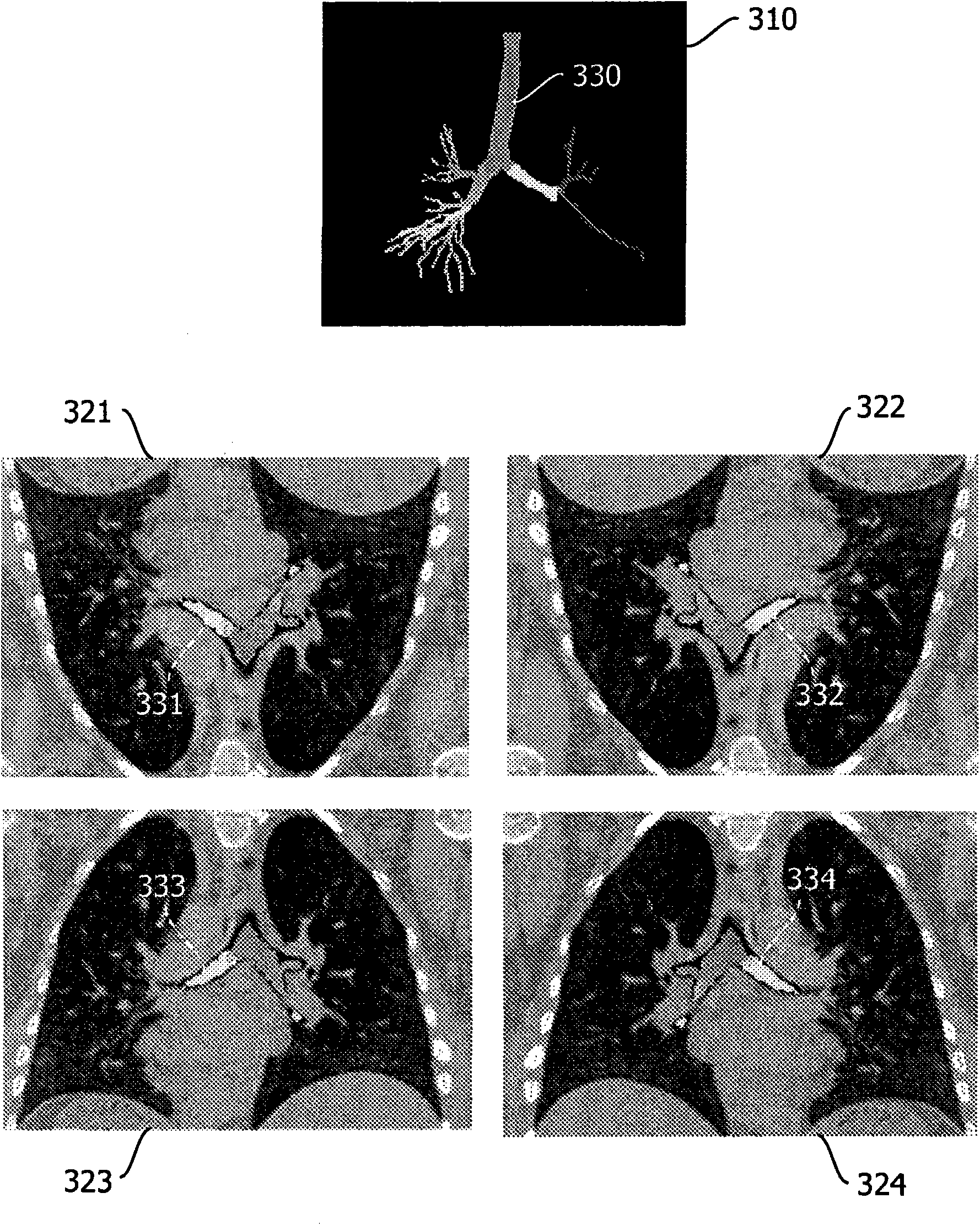 Method of automatically correcting mis-orientation of medical images