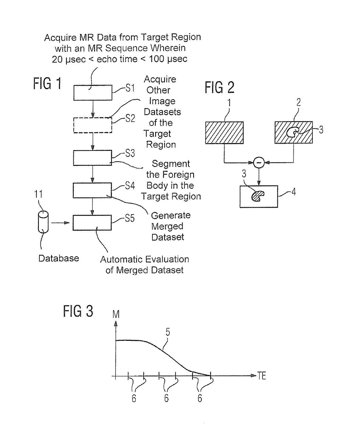 Method and apparatus for recording a magnetic resonance dataset of at least one foreign body in a patient