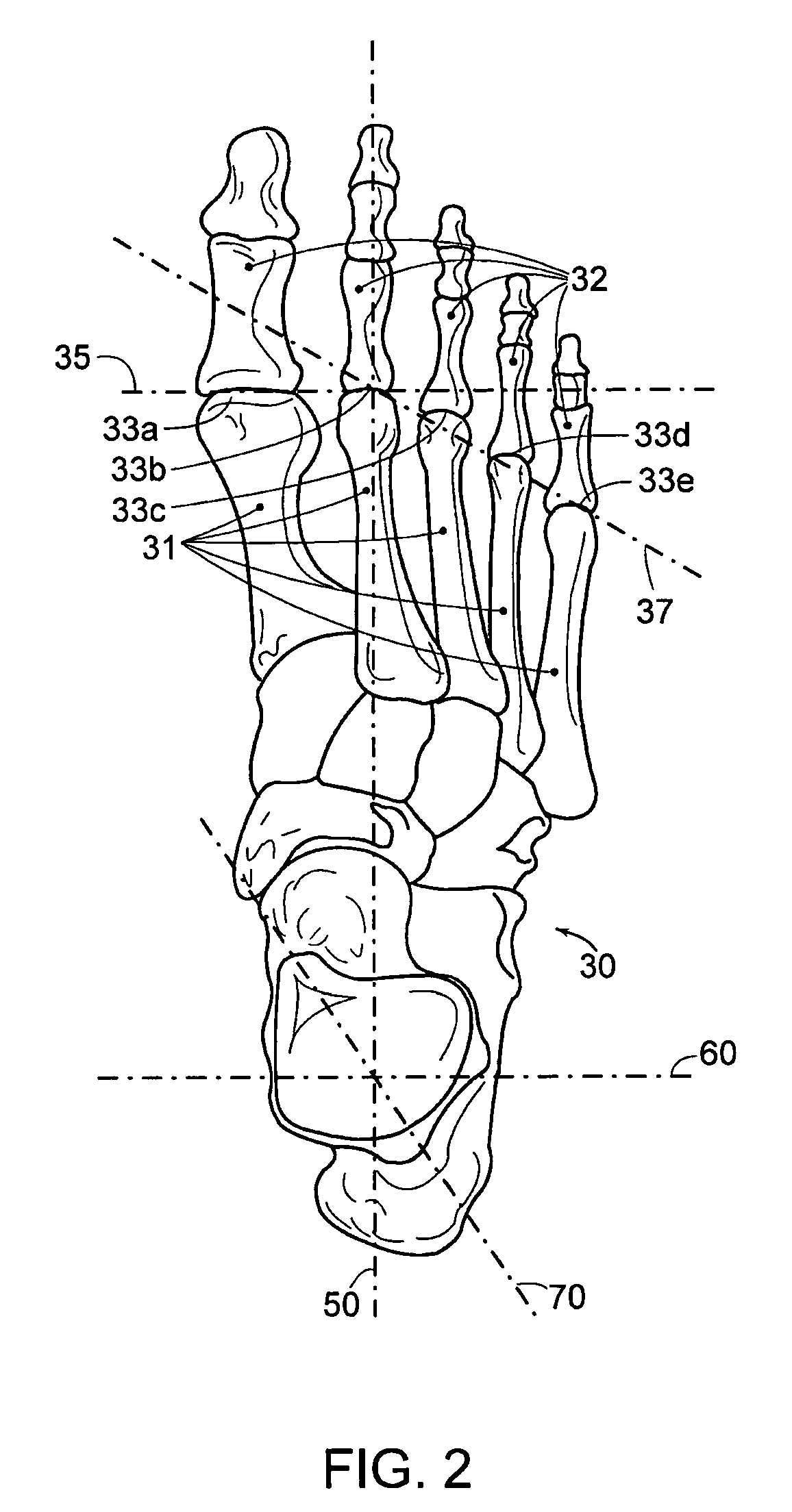 Shoe with optimal mass distribution