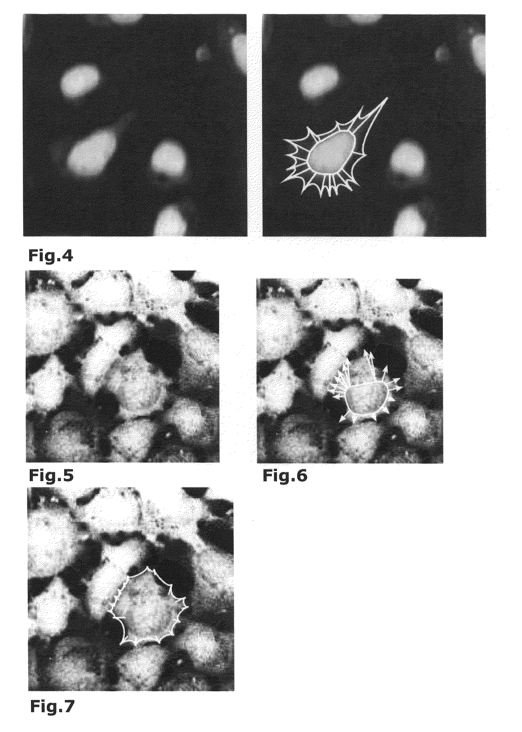 Method for Detecting Contours in Images of Biological Cells