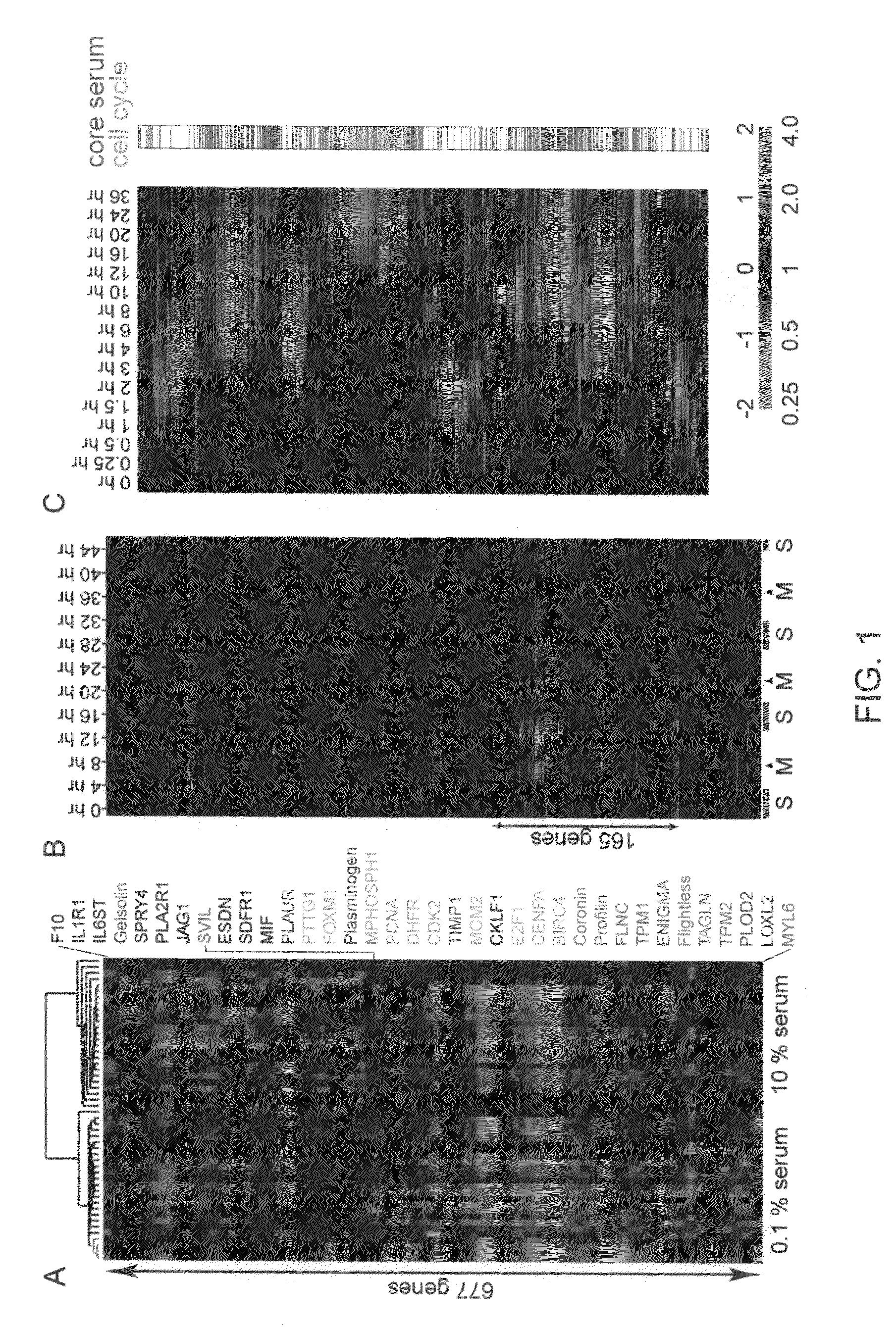 Gene expression signature for prediction of human cancer progression