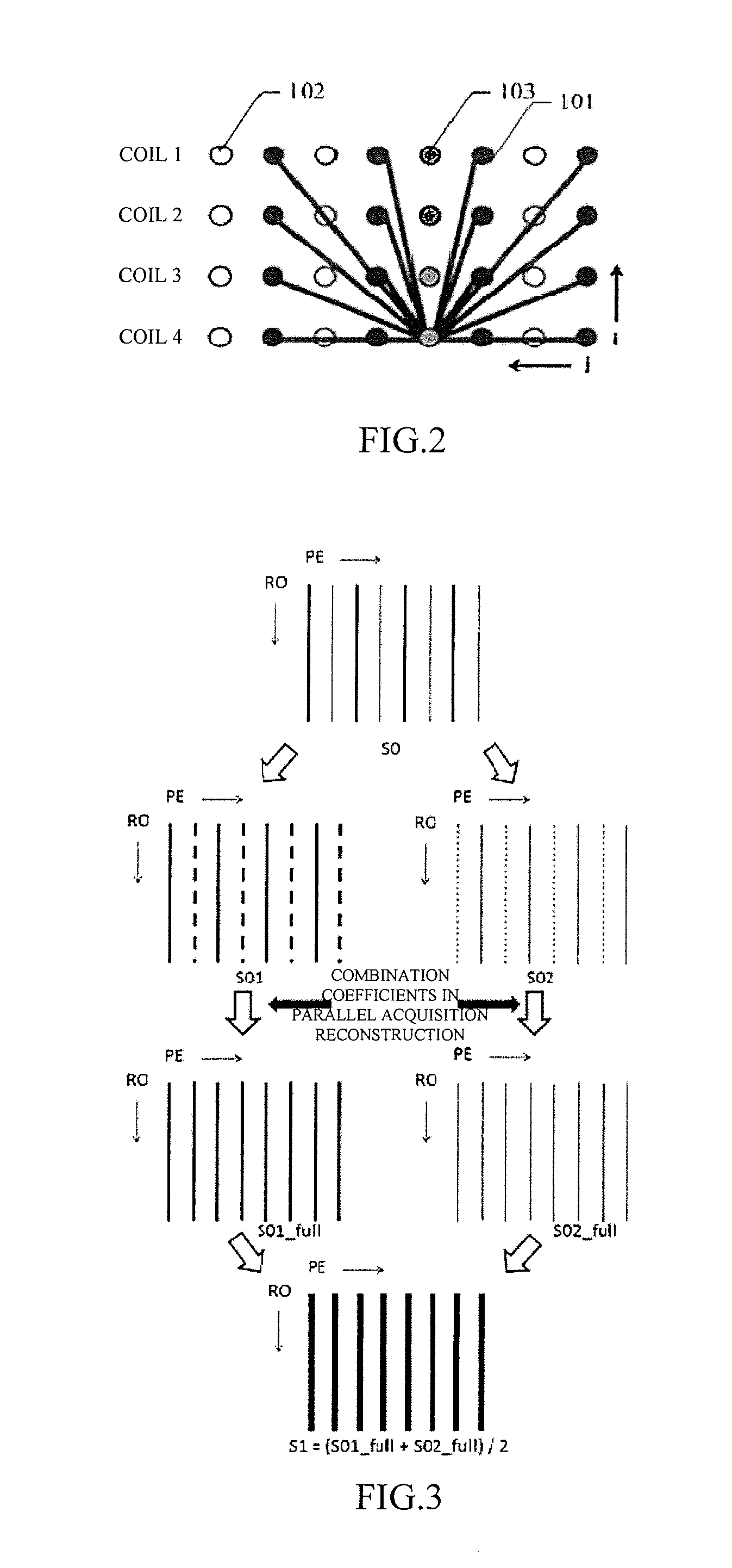 Method and Apparatus for Eliminating Motion Artifact in Magnetic Resonance Imaging