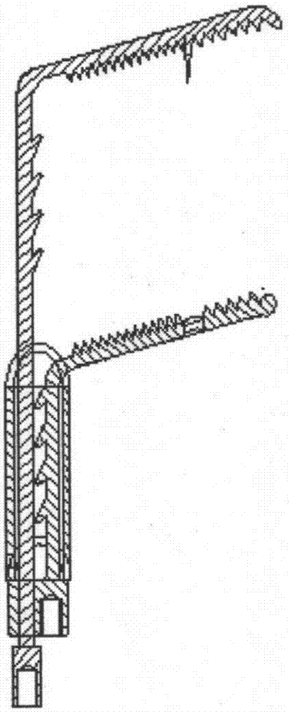 Intervention system for repairing mitral valve