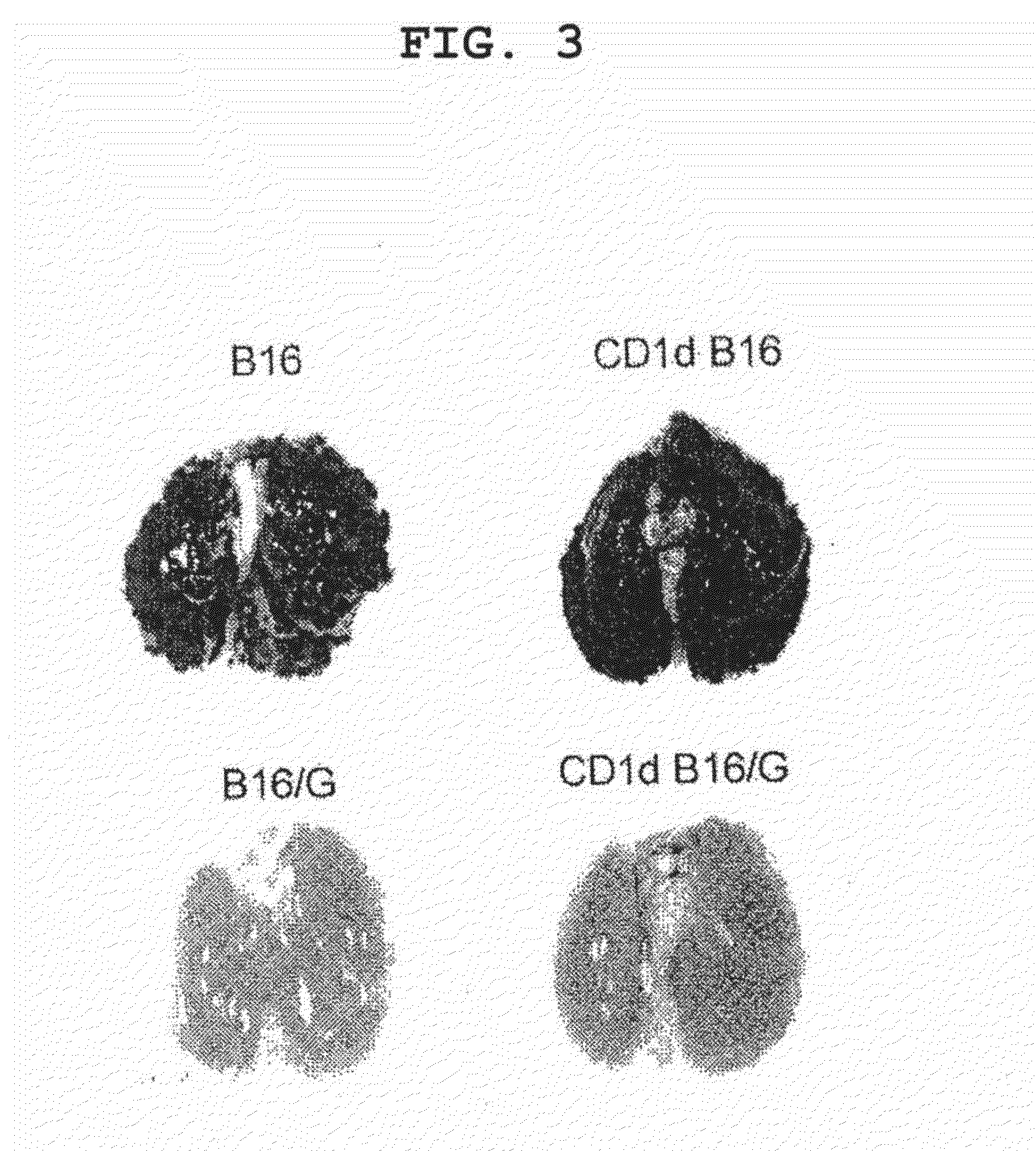 Immunotherapeutic method using artificial adjuvant vector cells that co-express cd1d and target antigen