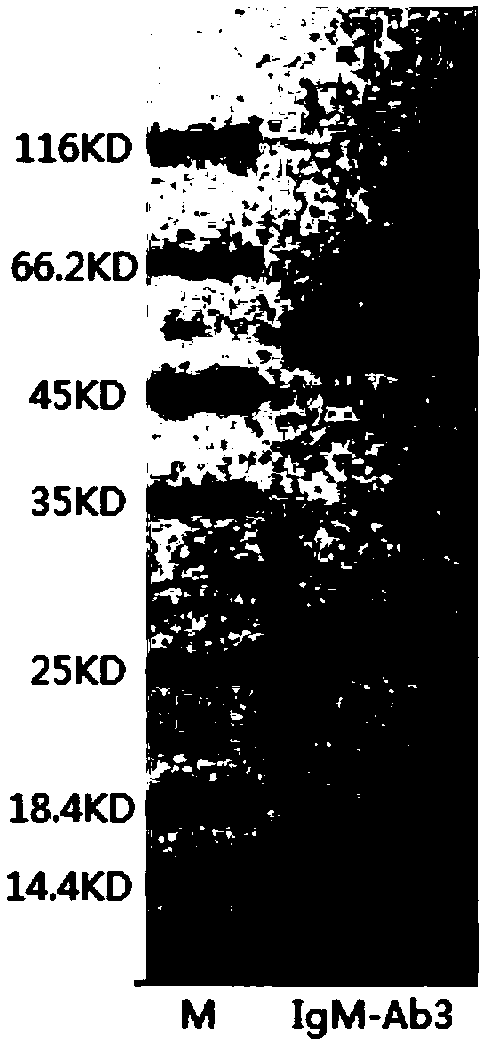 Anti-human IgM monoclonal antibody, hybridoma cell strain and application thereof