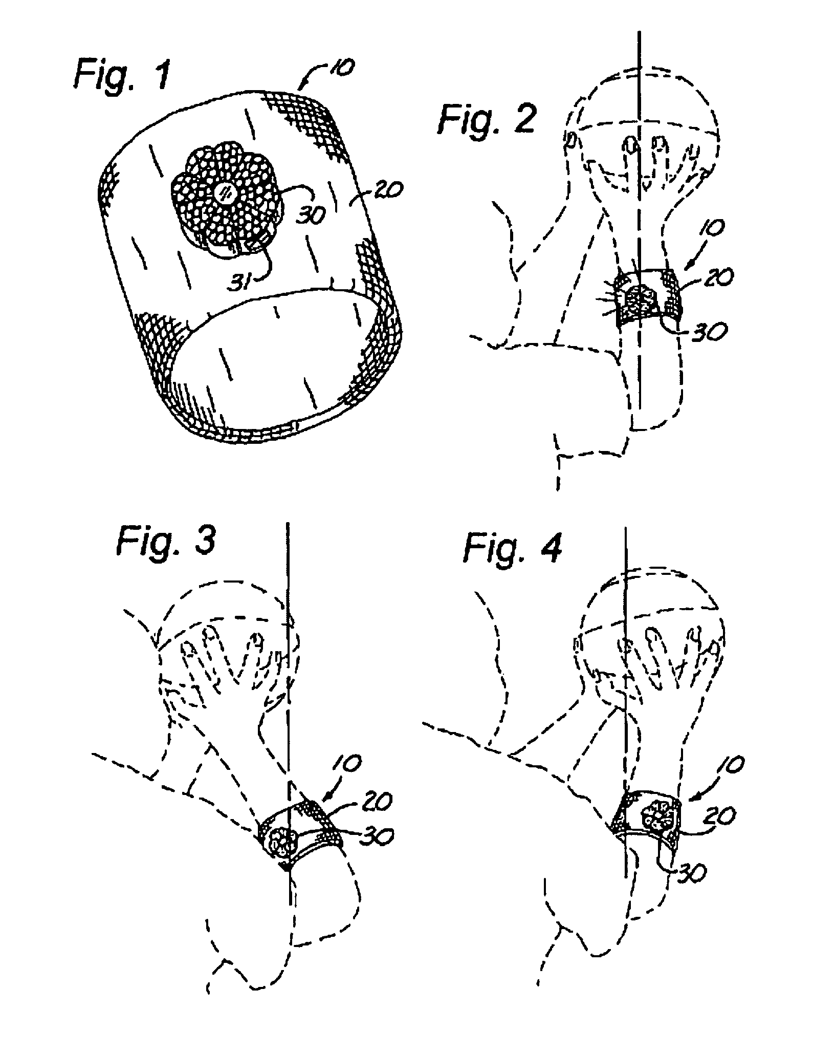 Basketball shooting training aid and method for its use