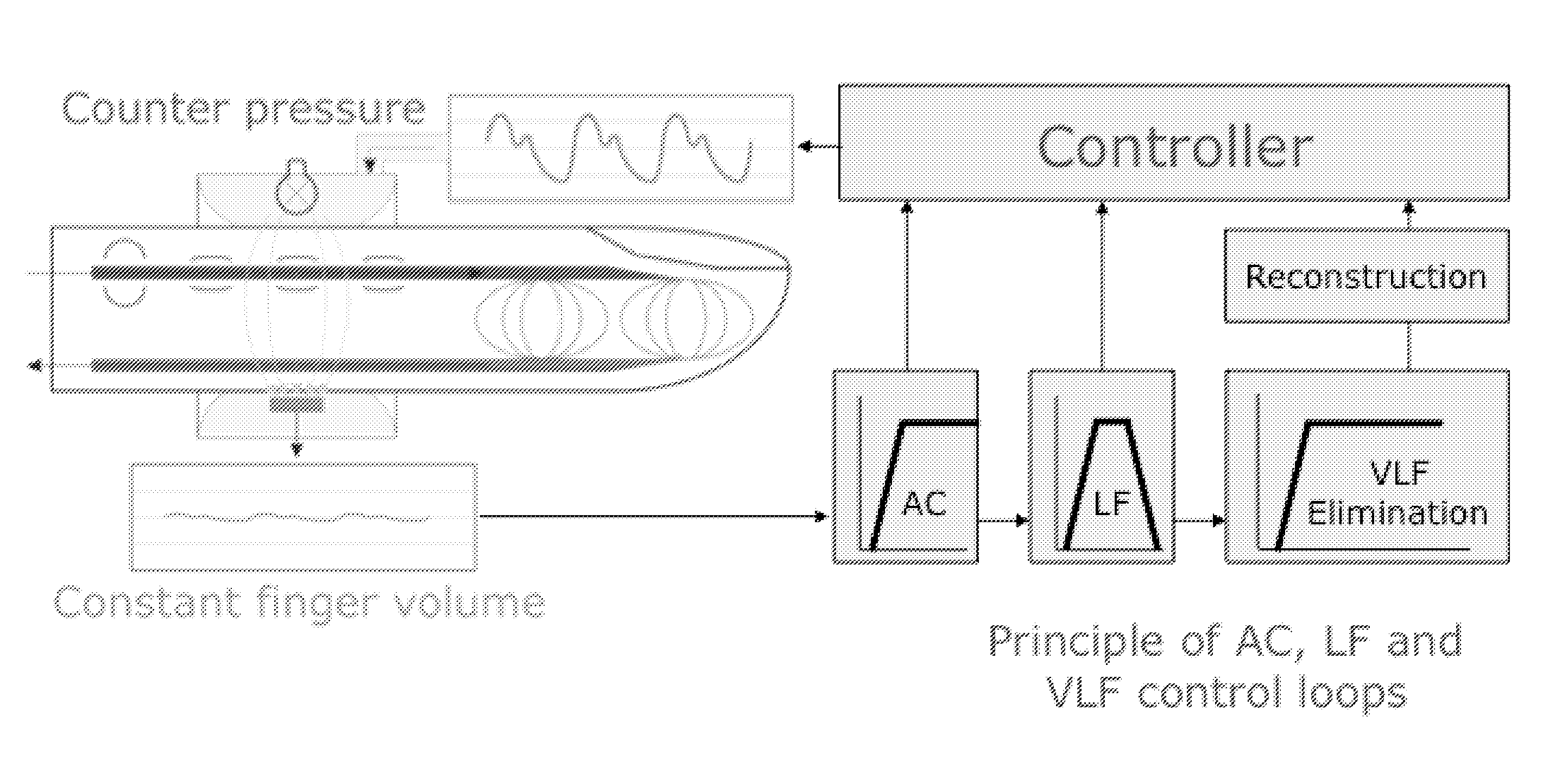 Apparatus and method for enhancing and analyzing signals from a continuous non-invasive blood pressure device