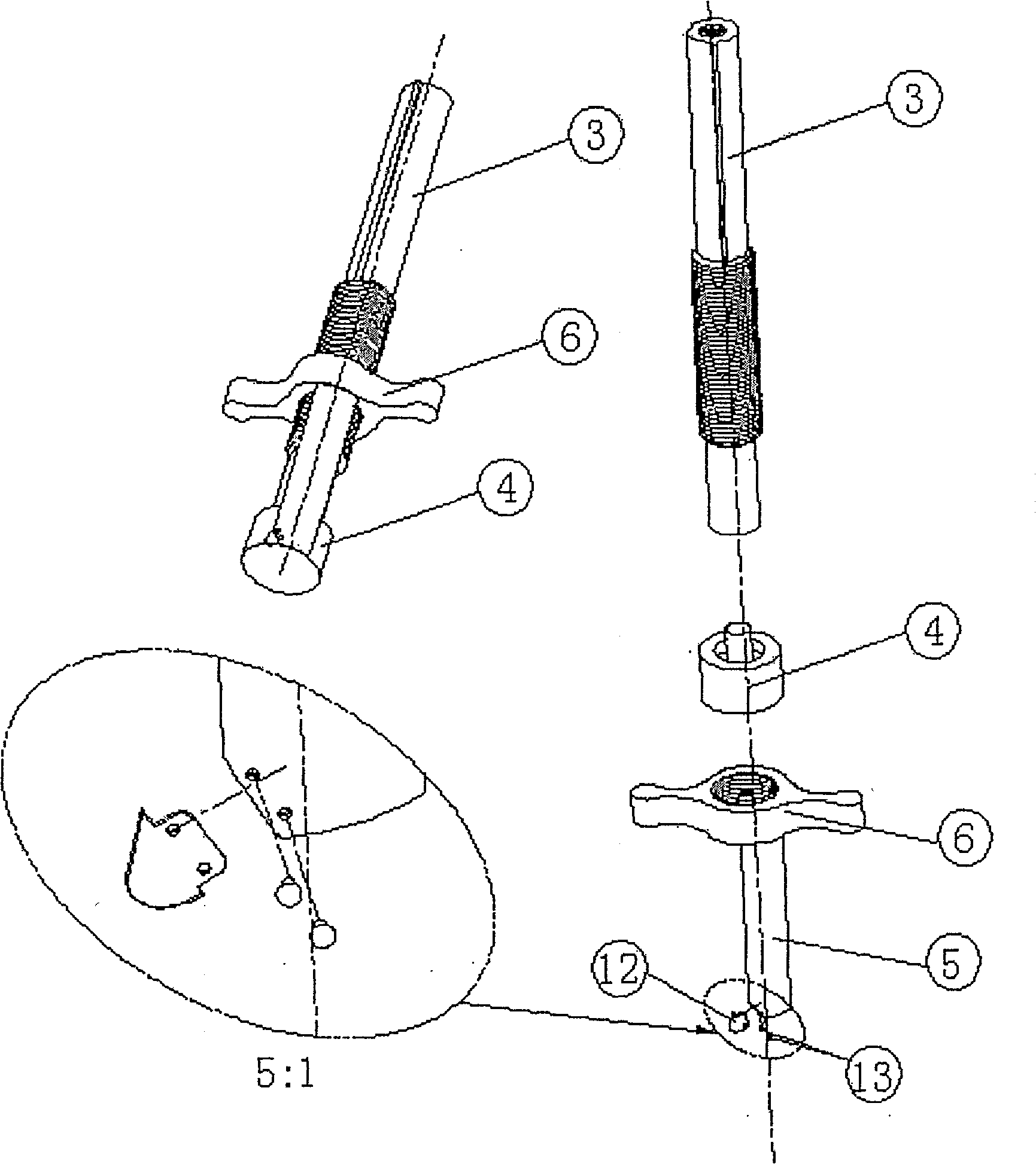 Special-purpose surgical knife tool component and technological process for human body colotomy