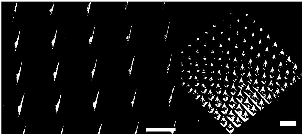 Self-adhesive microneedle patch capable of swelling rapidly and preparation method thereof