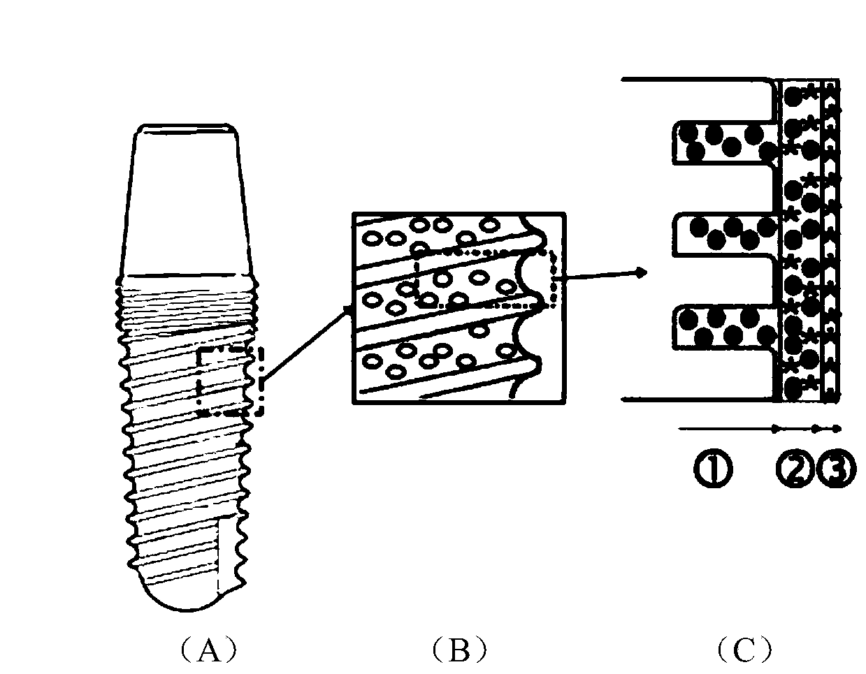 Dental implant with osteogenesis-anti-inflammation-blood glucose three-dimensional response structure and preparation method thereof