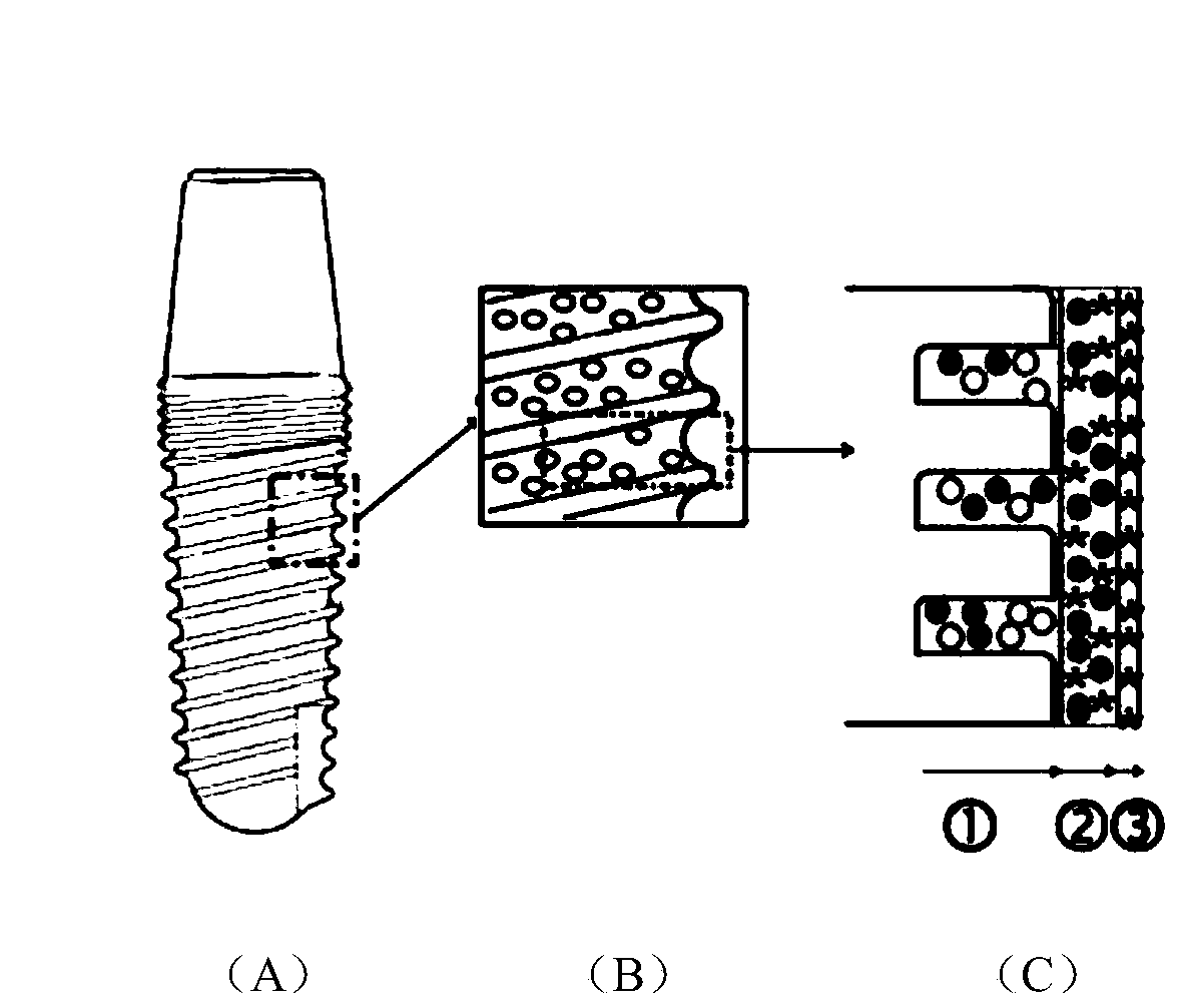 Dental implant with osteogenesis-anti-inflammation-blood glucose three-dimensional response structure and preparation method thereof