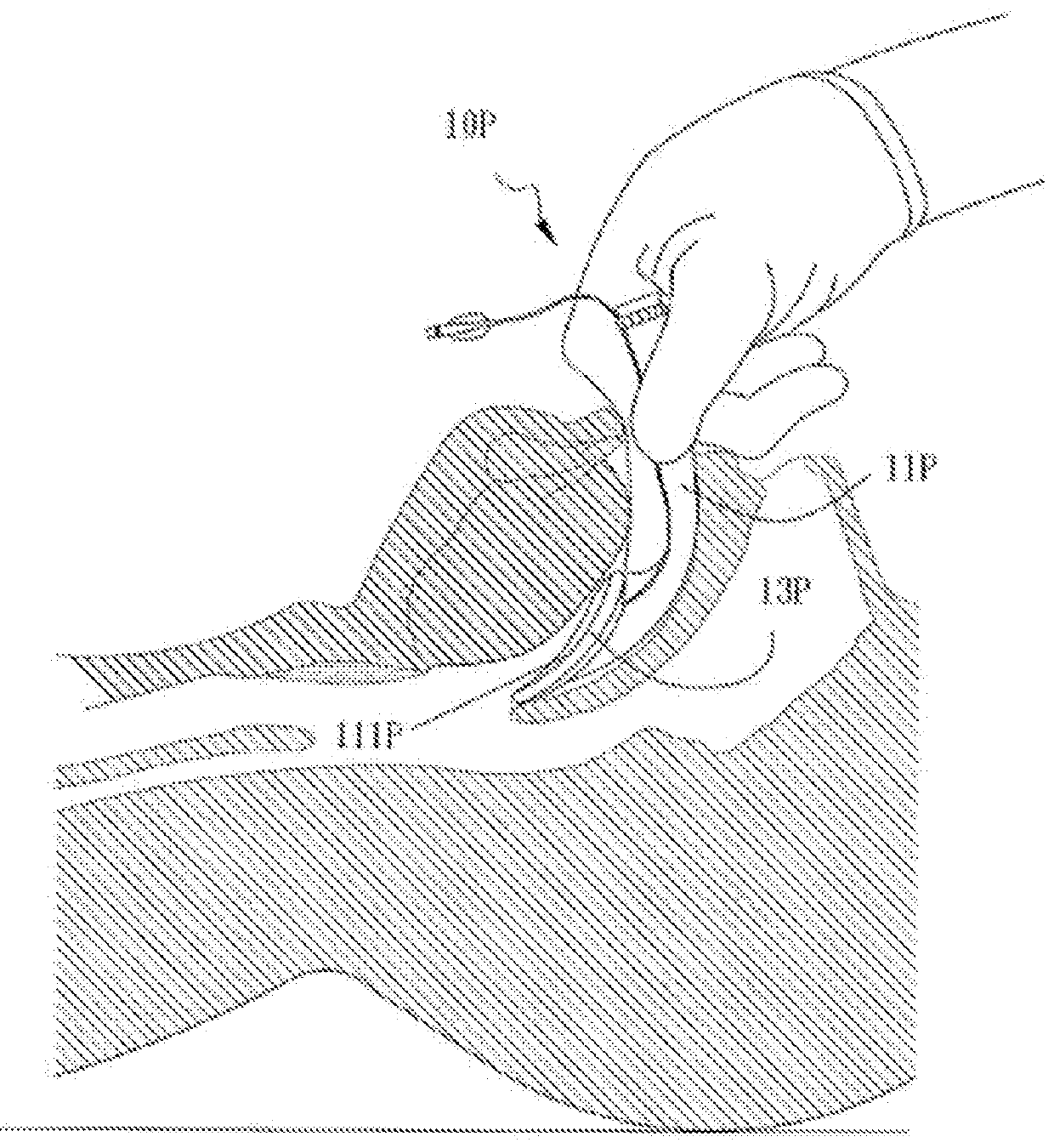 Airway device