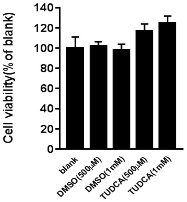 Application of tauroursodeoxycholic acid in anti-hand-foot-mouth virus and vesicular stomatitis virus drugs