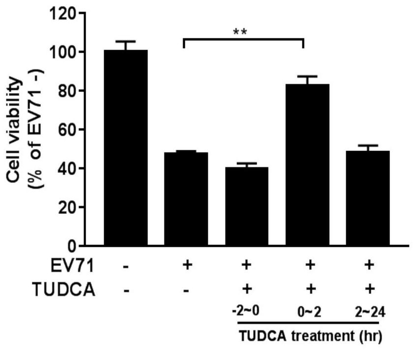 Application of tauroursodeoxycholic acid in anti-hand-foot-mouth virus and vesicular stomatitis virus drugs