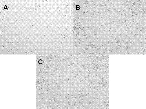 A method for surface-enhanced Raman detection of cancer cells based on self-assembled materials