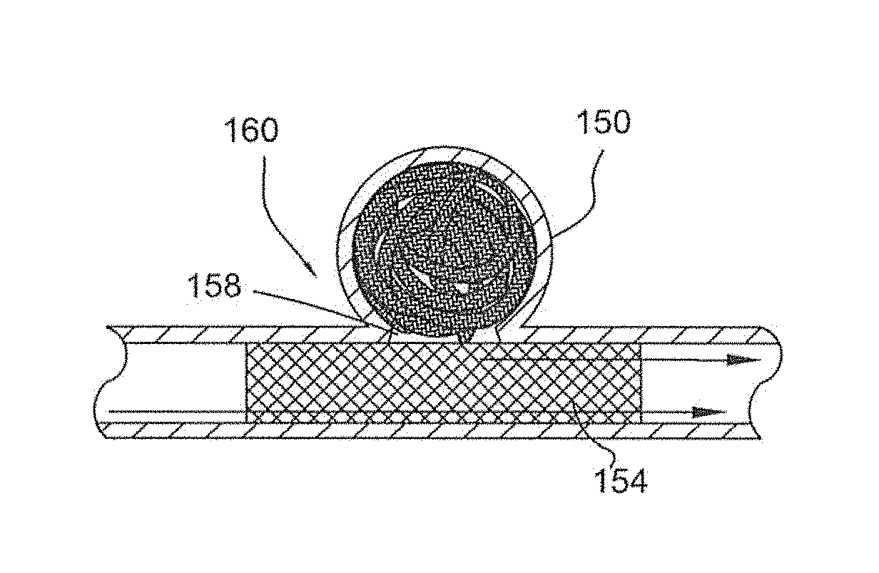 Packaging for surgical implant