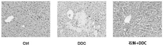 Preparation method of dendrobium alkaloid, medicine containing dendrobium alkaloid and application of dendrobium alkaloid in preparation of medicine for treating and inhibiting cholestasis