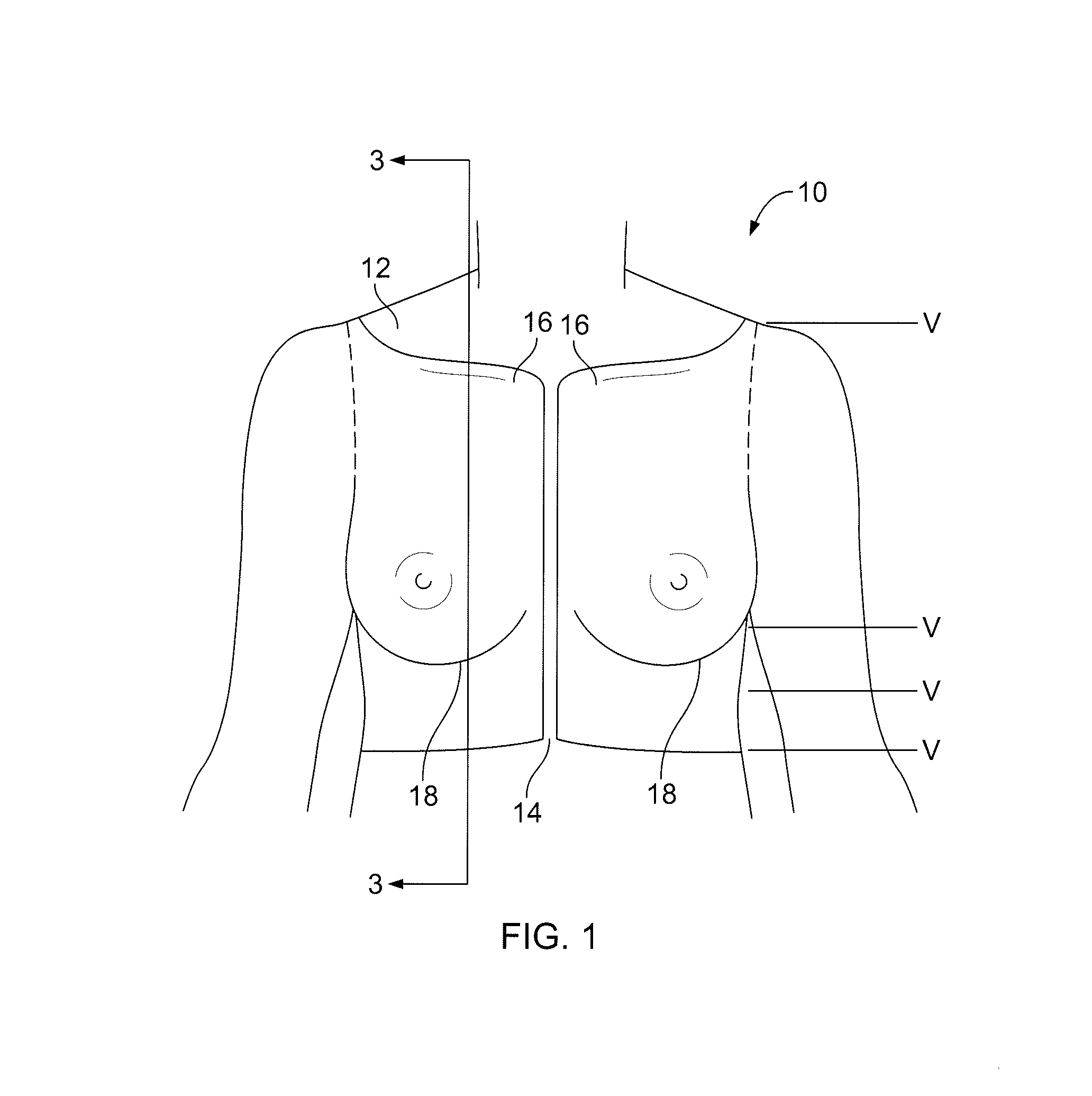 Breast implant teaching model