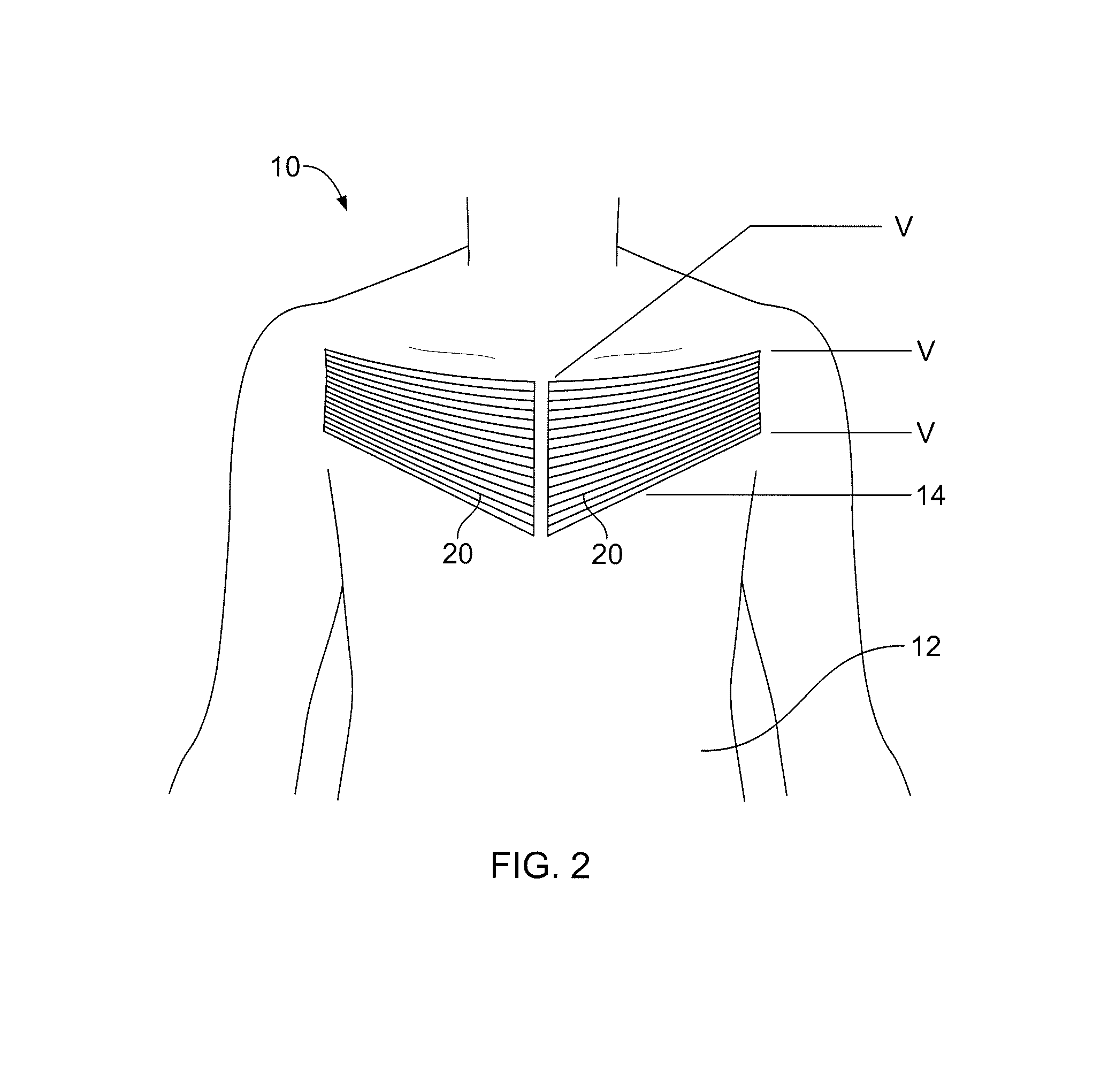 Breast implant teaching model