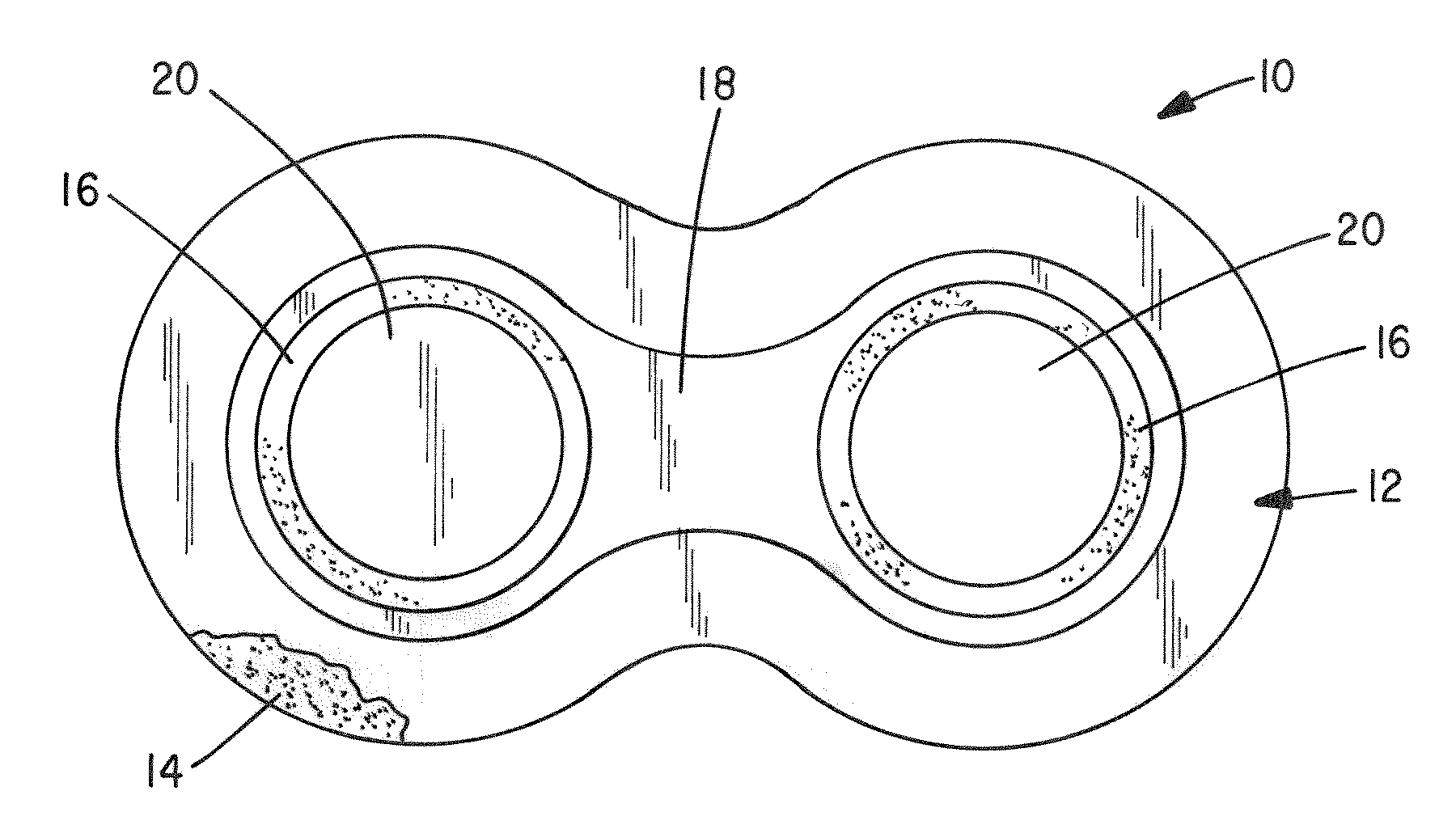 Transdermal Methods and Systems for the Delivery of Corticosteroid Compounds