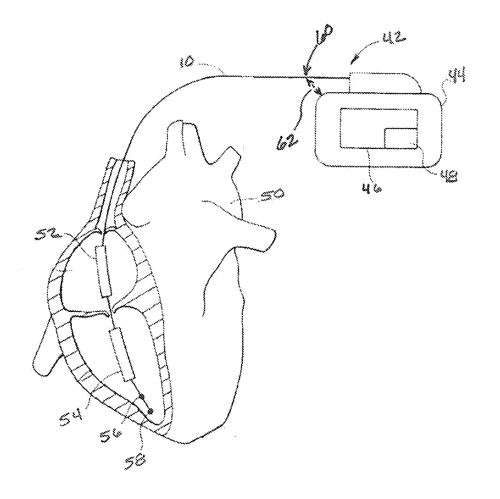 Method for detecting and treating insulation lead-to-housing failures