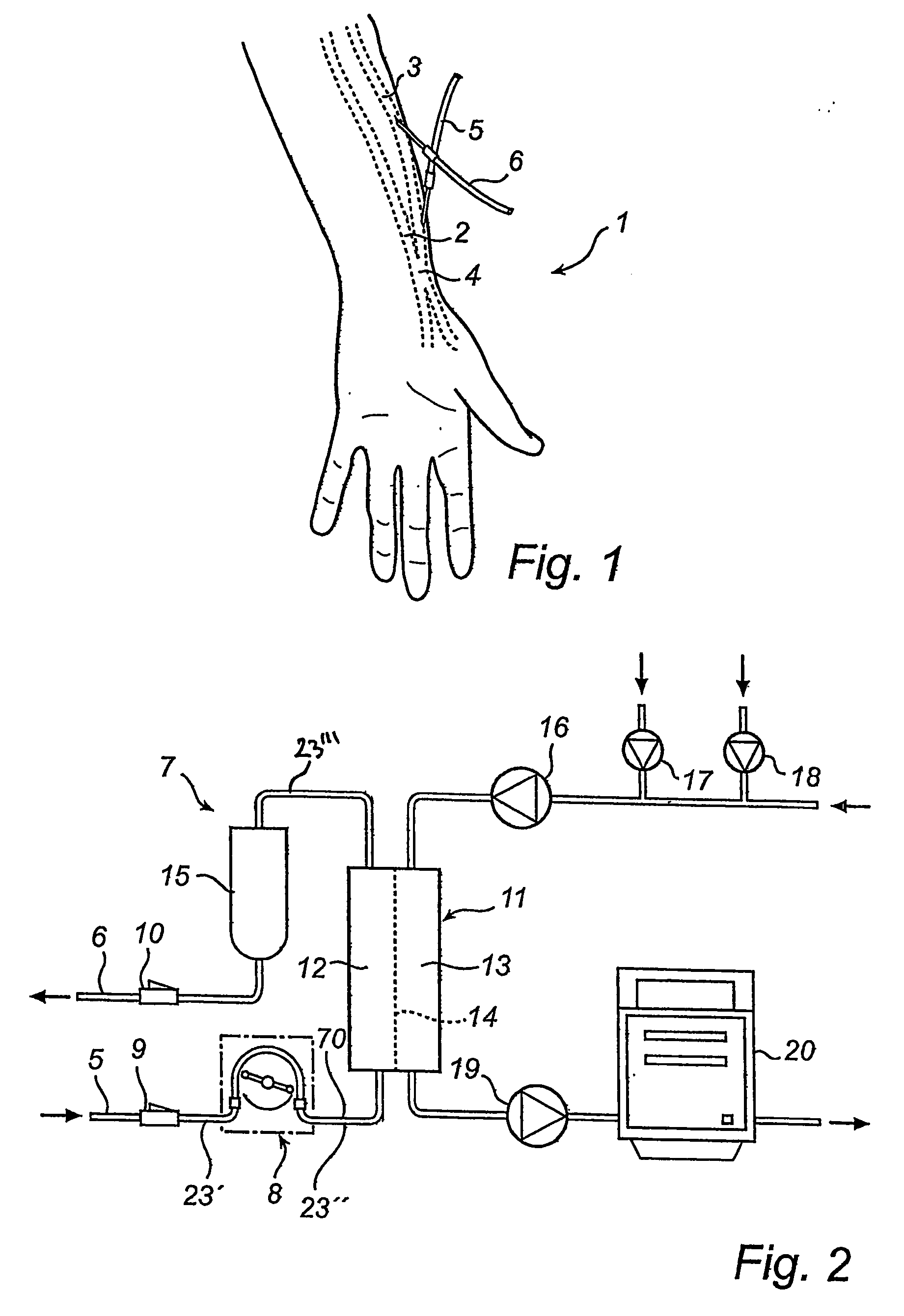 Pressure sensing