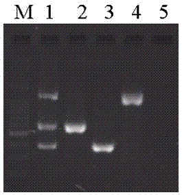 Kit for detecting cysticercus cellulosae, swine trichinella and swine toxoplasmosis and application