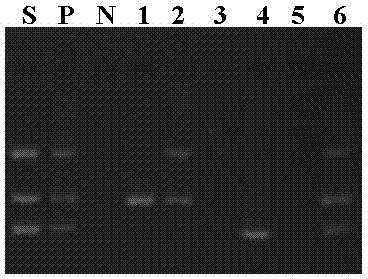 Kit for detecting cysticercus cellulosae, swine trichinella and swine toxoplasmosis and application