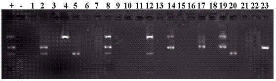 Kit for detecting cysticercus cellulosae, swine trichinella and swine toxoplasmosis and application