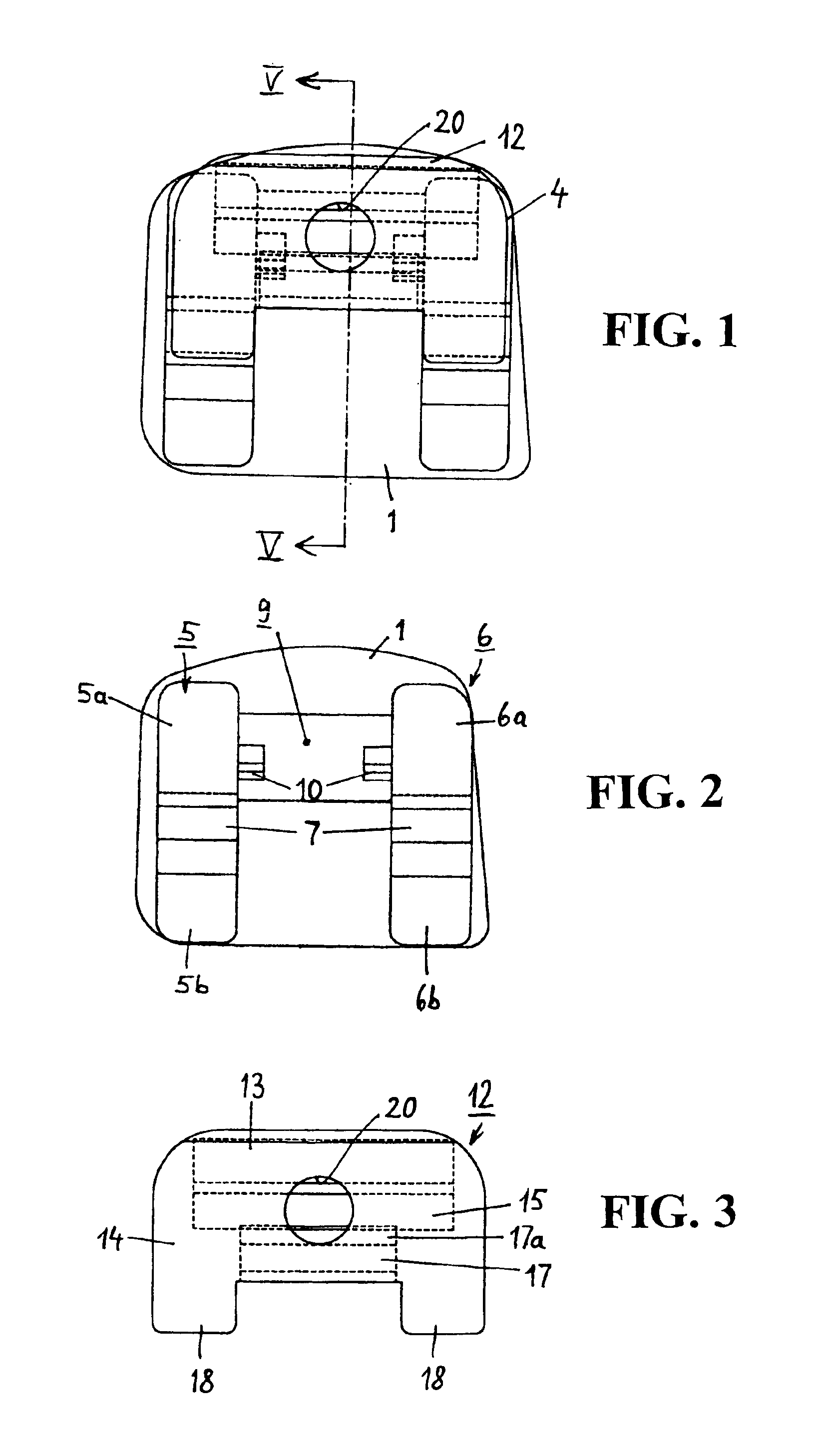 Orthodontic bracket