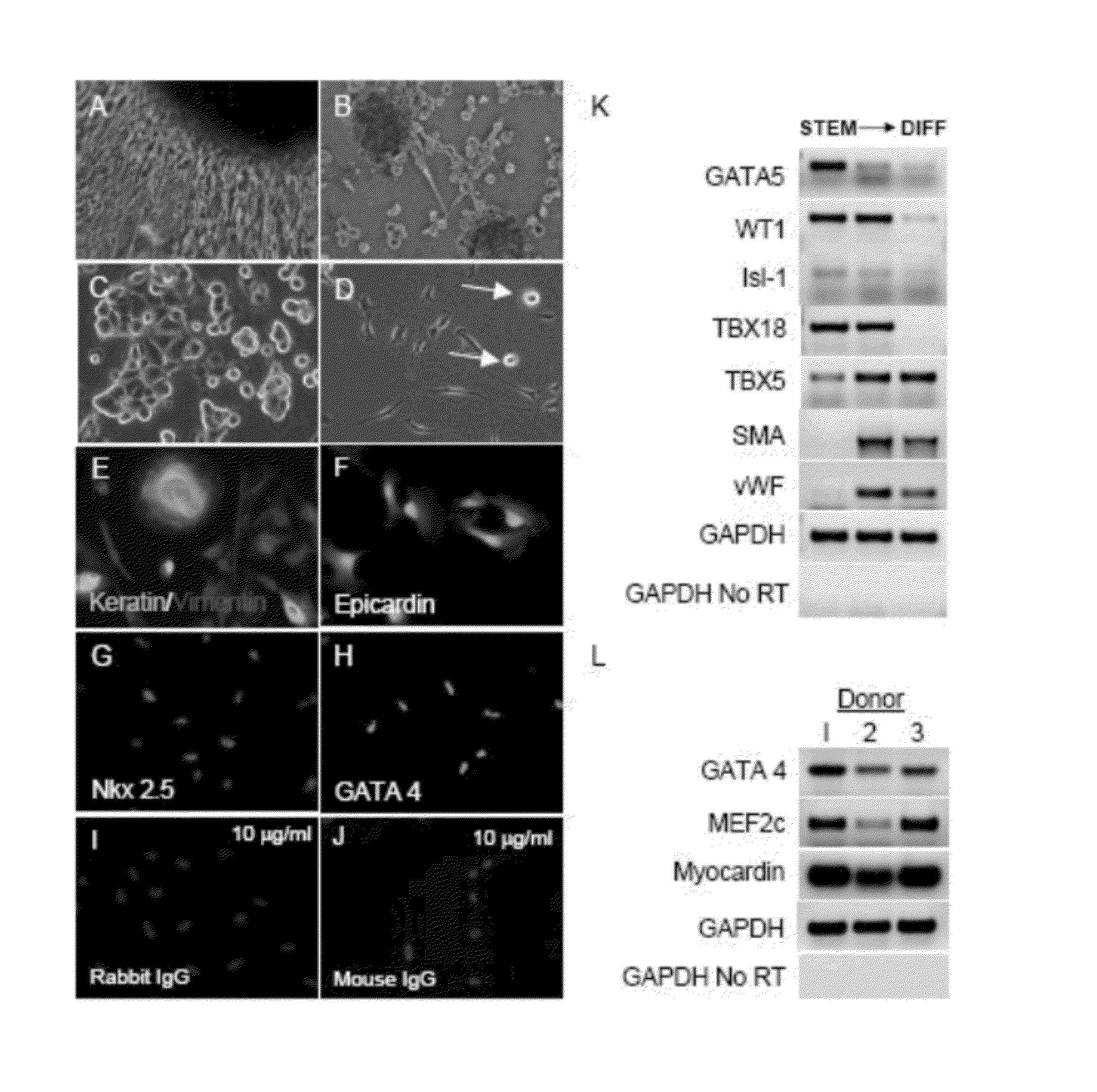 Compositions and methods for cardiac tissue repair