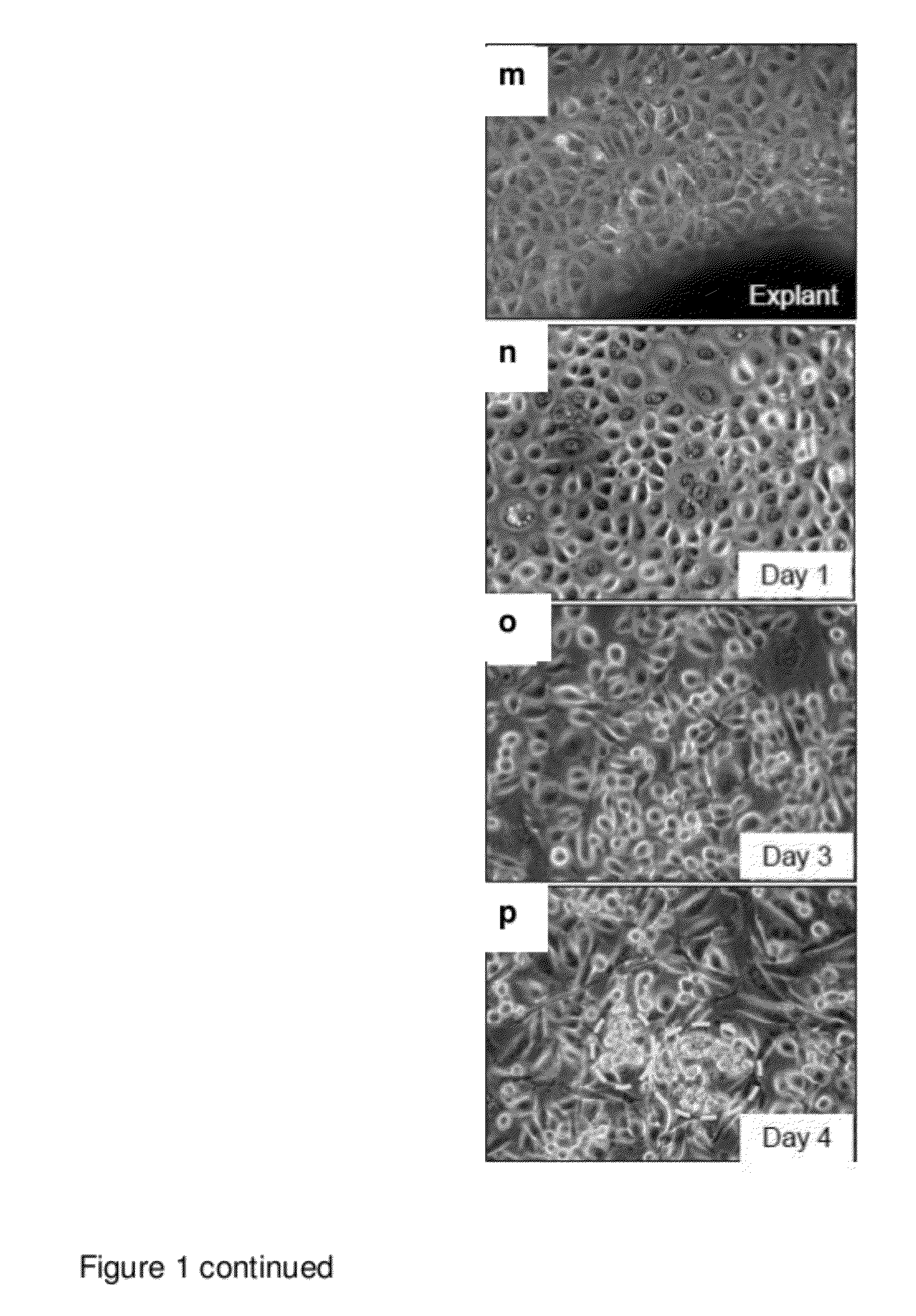 Compositions and methods for cardiac tissue repair