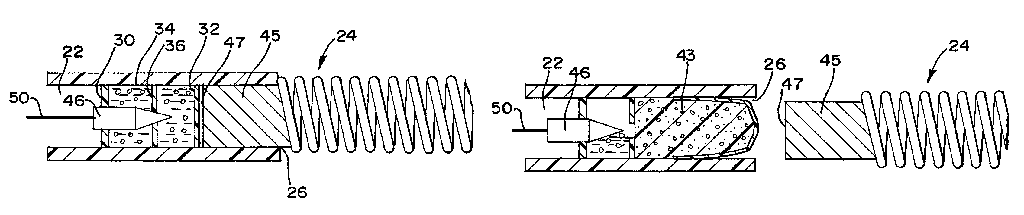 Chemically based vascular occlusion device deployment