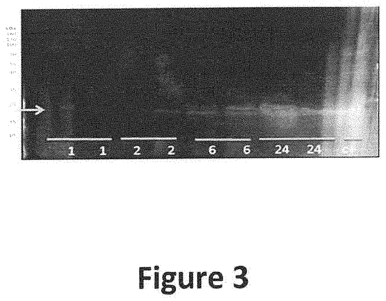 Transformed, salmo salar interferon gamma (ifng)-producing lactococcus lactis bacterium, food and composition comprising same, for immunostimulation in aquaculture species