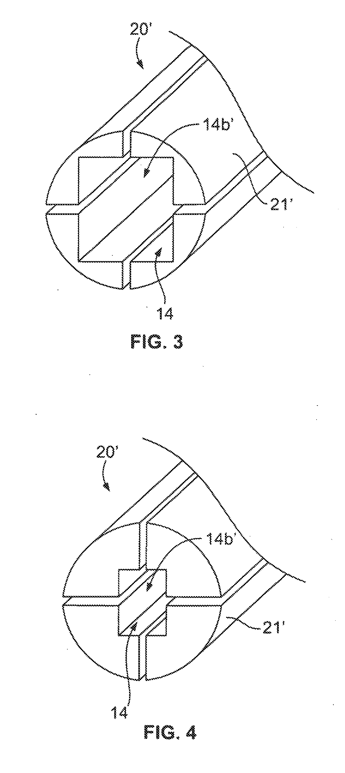 Configurable Intervertebral Implant