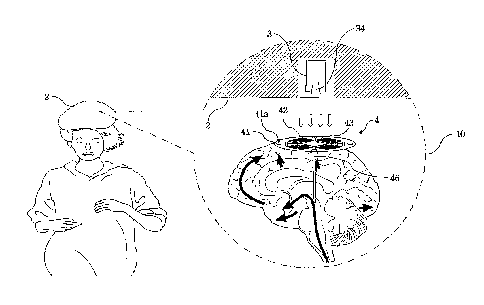 Deep Brain Stimulation Device Having Wireless Power Transmission Mechanism