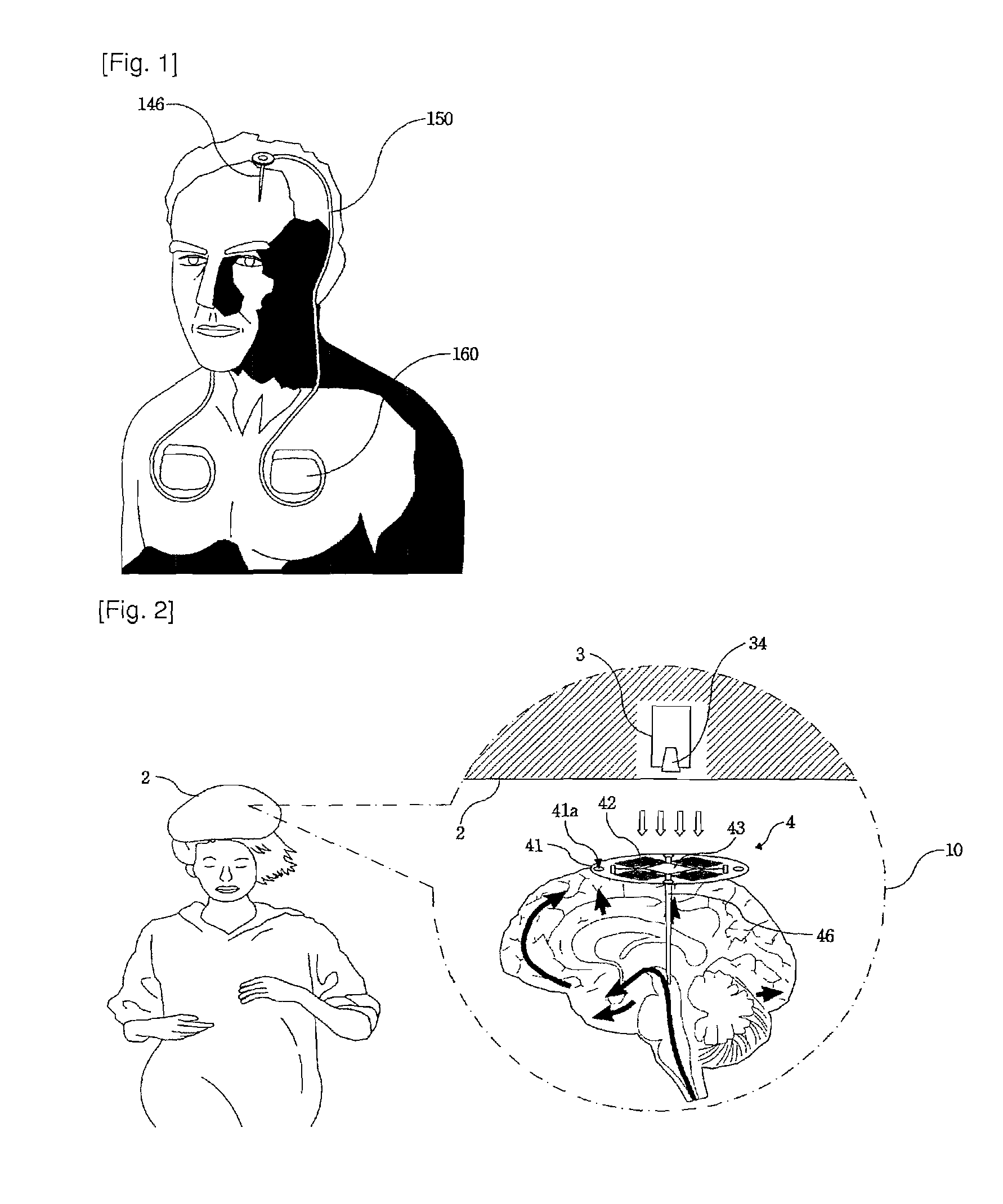 Deep Brain Stimulation Device Having Wireless Power Transmission Mechanism