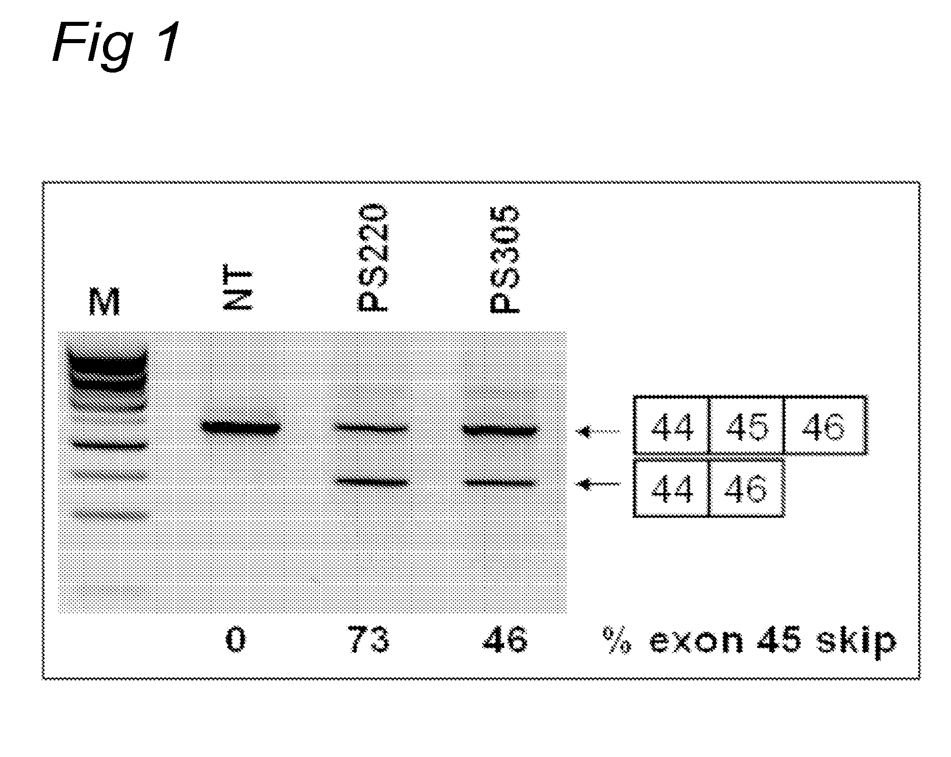 Oligonucleotide comprising an inosine for treating dmd