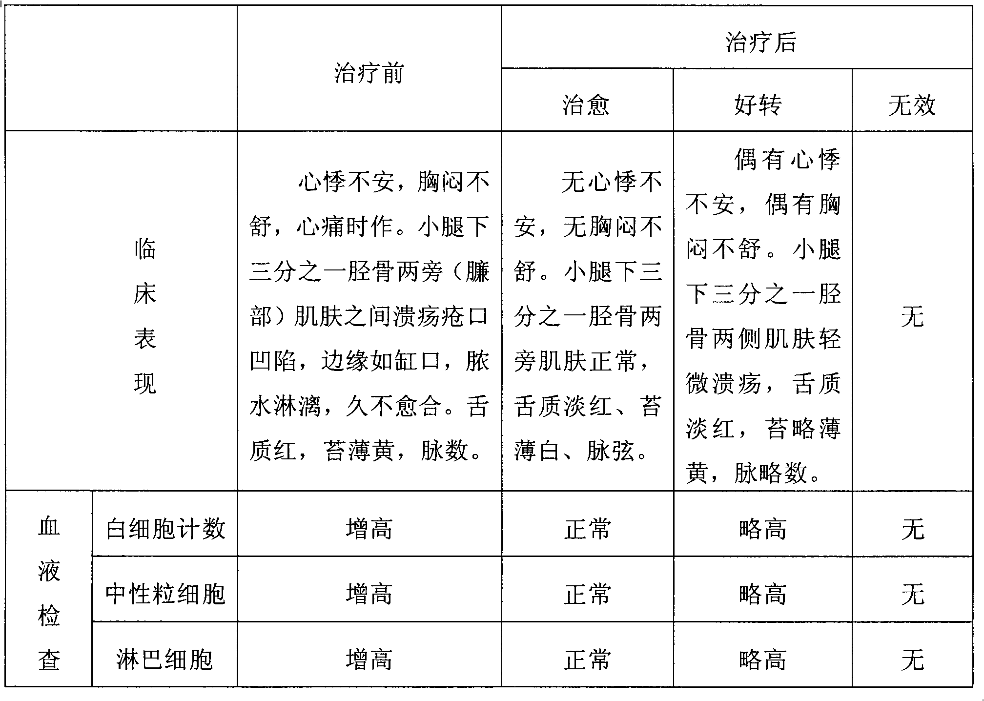 Preparation method for traditional Chinese medicine lotion for treating heart blood stasis type ecthyma