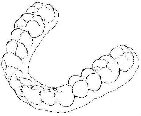 Reasonable arrangement inducing device for teeth of children and manufacturing method thereof