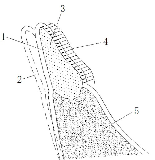 Reasonable arrangement inducing device for teeth of children and manufacturing method thereof