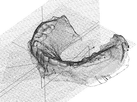 Reasonable arrangement inducing device for teeth of children and manufacturing method thereof