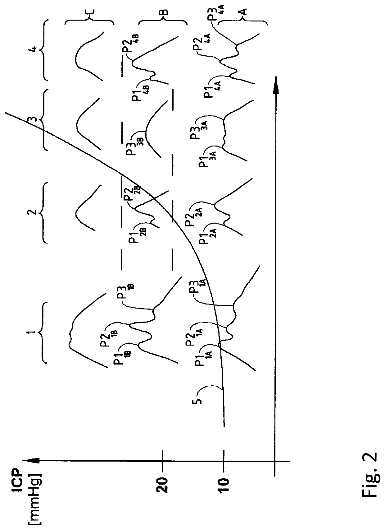 Measurement system and method for measuring parameters in a body tissue